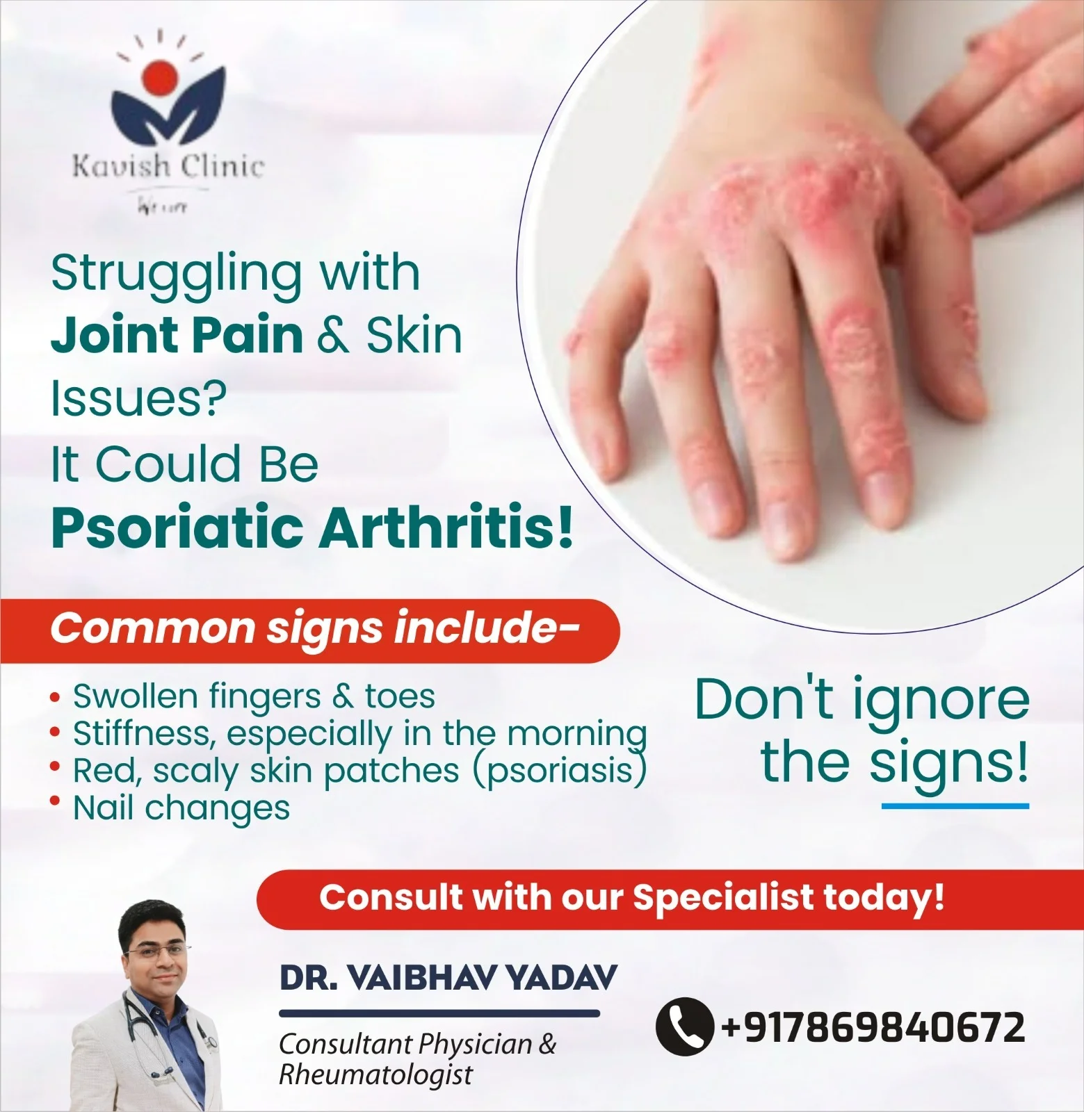 Psoriatic Arthritis Treatment in Indore